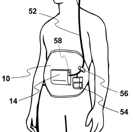 Innovations in mechanical ventilators